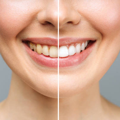 ESTETICA DENTALE