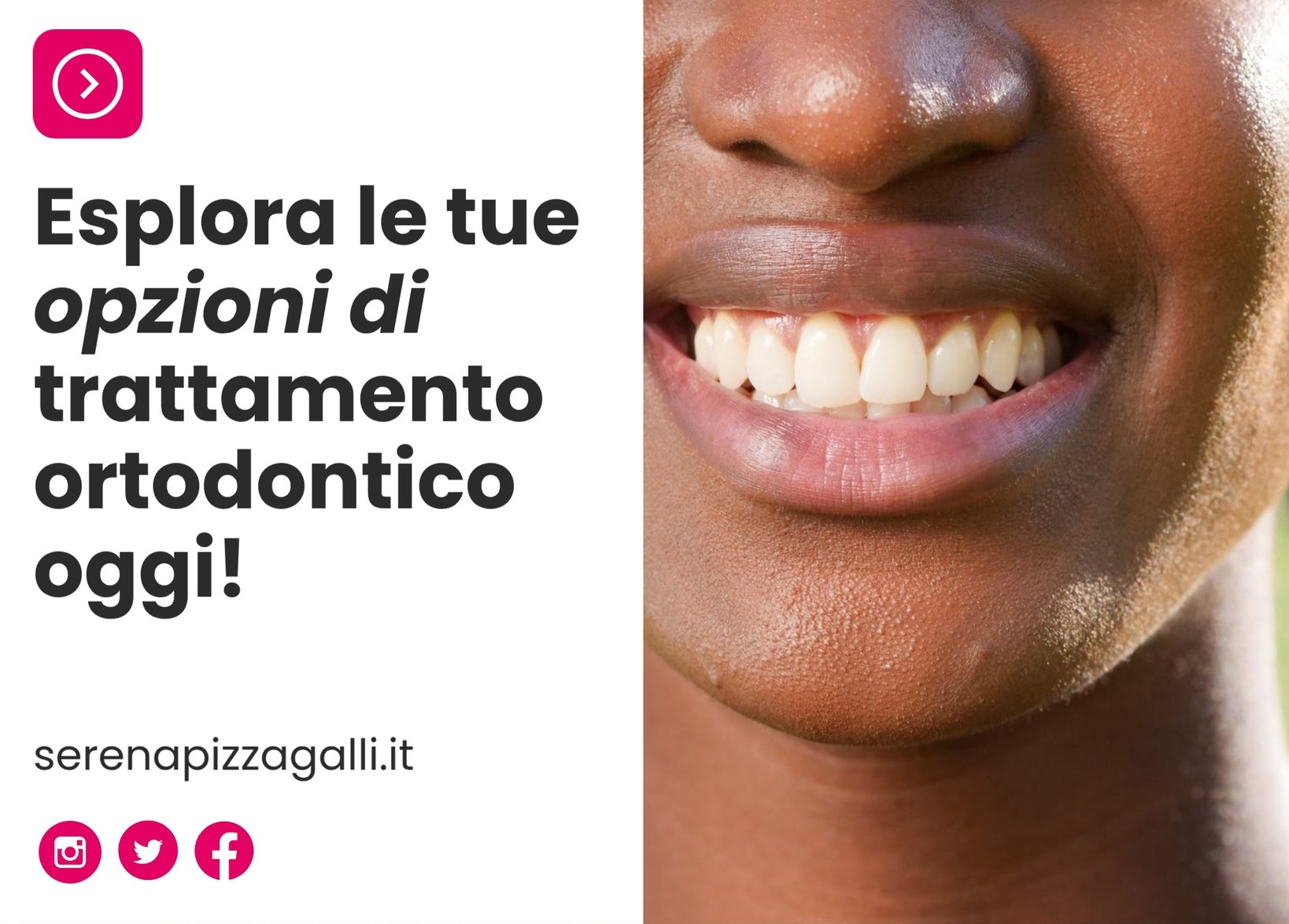 Ortodonzia Invisibile a Giulianova
