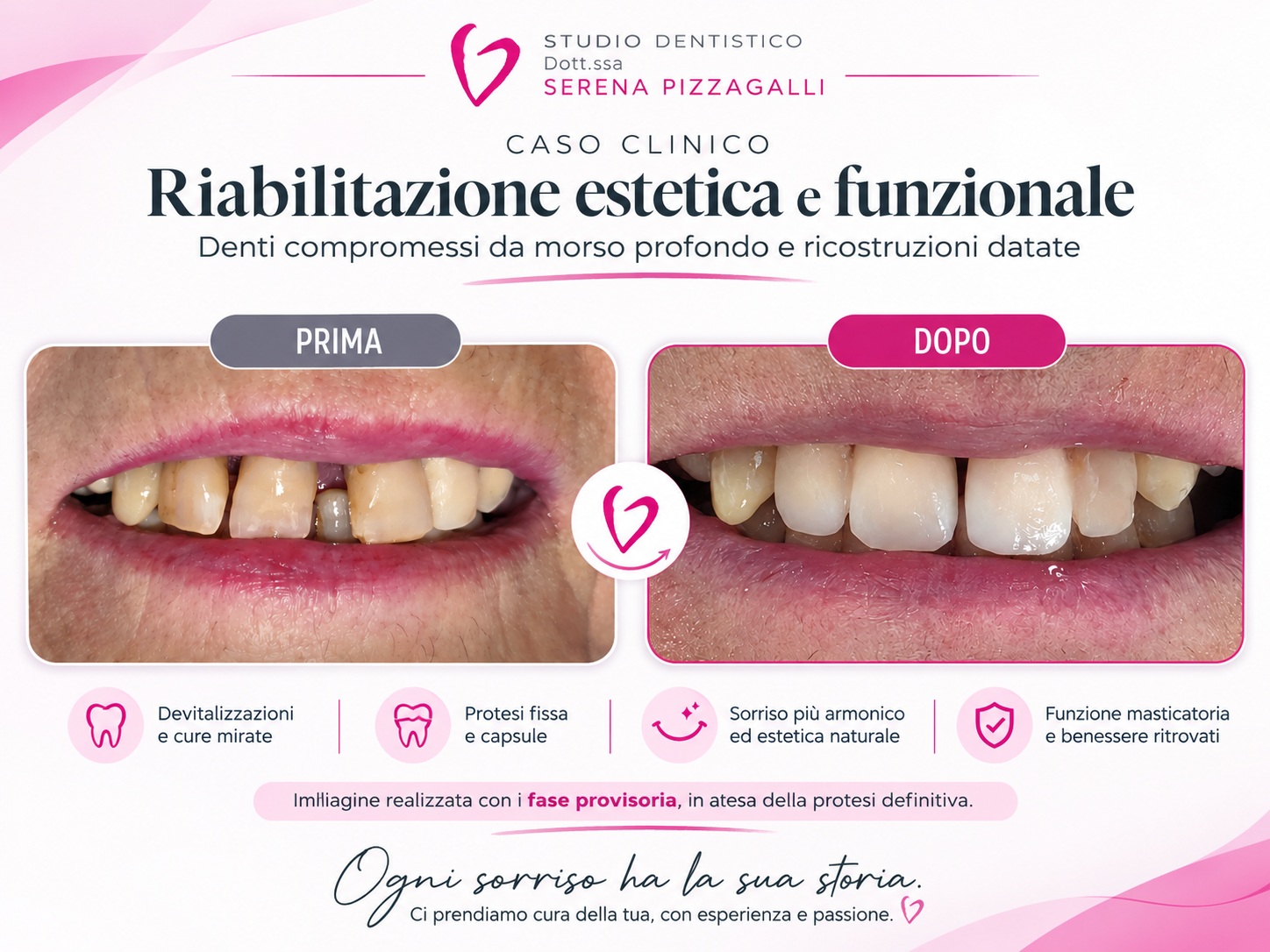 Morso profondo e denti compromessi: caso clinico