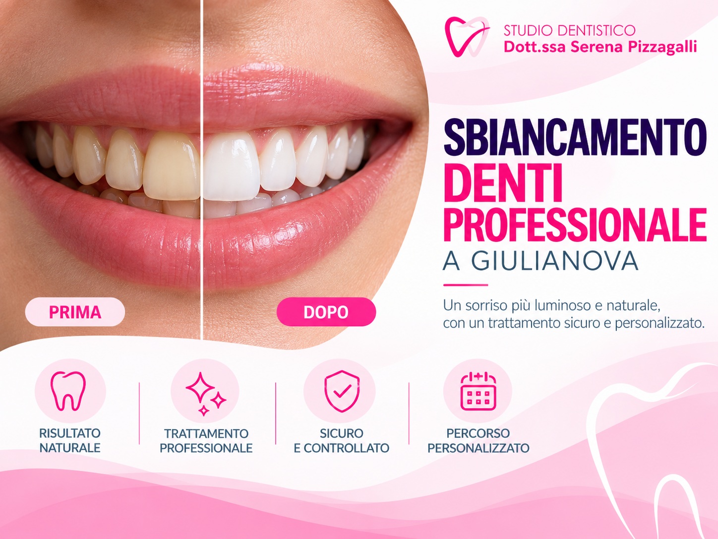 Sbiancamento Denti Professionale Giulianova | Studio Pizzagalli